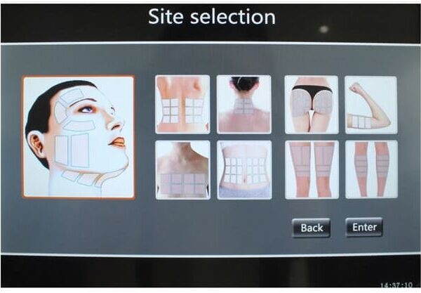 Hifu 3D - Imagen 6