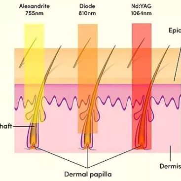 Piernas suaves y sin vello tras tratamiento láser en WAM Center | Clínica Estética, maximiza tu confianza.