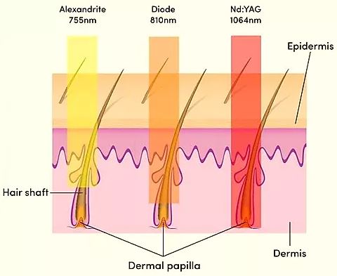 Piernas suaves y sin vello tras tratamiento láser en WAM Center | Clínica Estética, maximiza tu confianza.