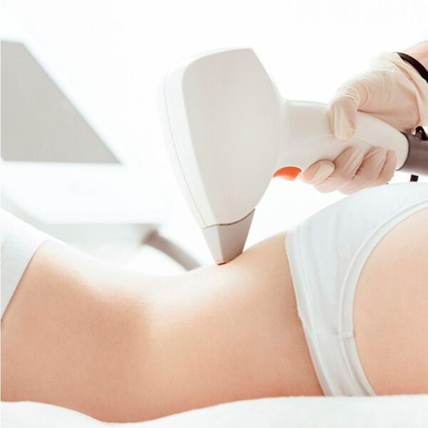 Tratamiento de depilación láser en piernas completas en WAM Center | Clínica Estética para suavidad duradera.