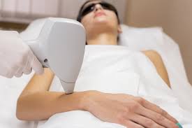 Mujer recibiendo tratamiento de depilación láser en WAM Center | Clínica Estética, ambiente profesional y seguro.