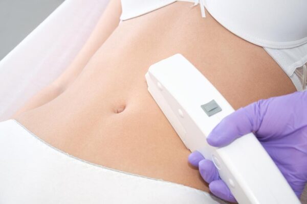 Depilación láser zona mediana en WAM Center | Clínica Estética: resultados precisos y confort garantizado.