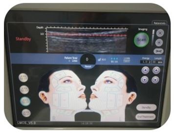 Tratamiento facial HIFU 3D en WAM Center | Clínica Estética: precisión avanzada para rejuvenecer tu piel.