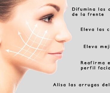 Tratamiento HIFU 3D en WAM Center | Clínica Estética para rejuvenecimiento facial y corporal eficaz y seguro.