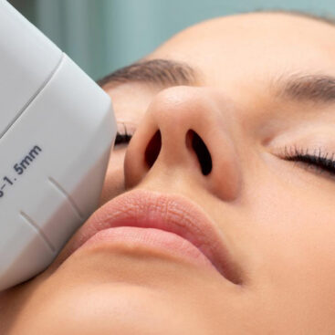 Tratamiento HIFU 3D innovador en WAM Center | Clínica Estética para rejuvenecimiento facial y corporal efectivo.