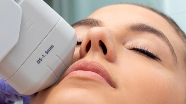 HIFU-3D.jpg Tratamiento HIFU 3D innovador en WAM Center | Clínica Estética para rejuvenecimiento facial y corporal efectivo.