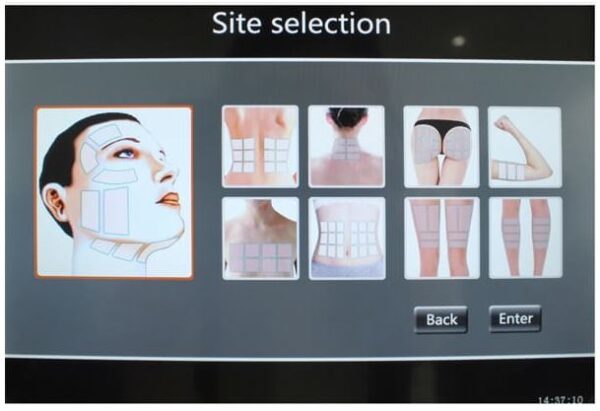 Equipo HIFU 3D en WAM Center | Clínica Estética, tecnología avanzada para tratamientos de rejuvenecimiento facial.