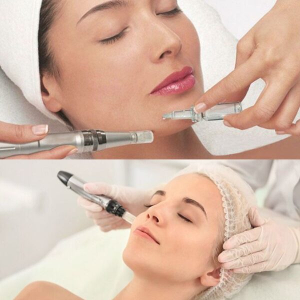 Mujer recibiendo tratamiento de mesoterapia facial en WAM Center | Clínica Estética, piel más firme y rejuvenecida.