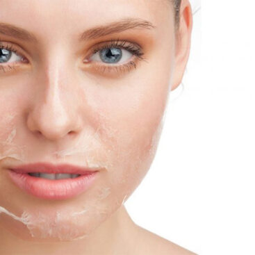 Peeling facial en WAM Center | Clínica Estética: rejuvenece y revitaliza tu piel en una sesión profesional.