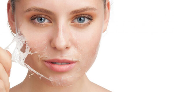 Peeling-Facial.jpg Peeling facial en WAM Center | Clínica Estética: rejuvenece y revitaliza tu piel en una sesión profesional.