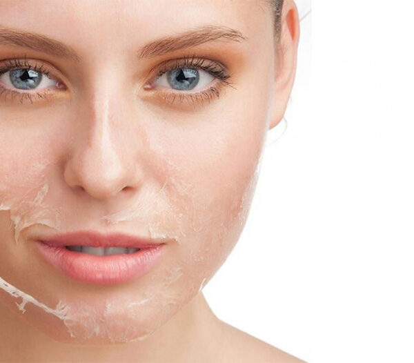 Peeling facial en WAM Center | Clínica Estética: rejuvenece y revitaliza tu piel en una sesión profesional.