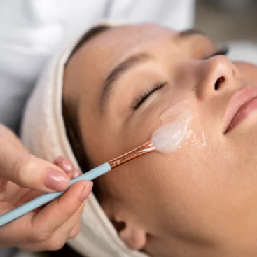 Peeling facial en WAM Center | Clínica Estética: rejuvenece y revitaliza tu piel en una sesión profesional.