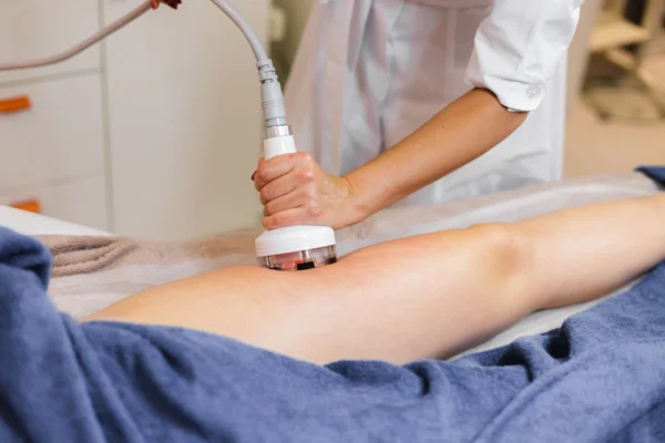 Aplicación de tratamiento anticelulitis edematosa en piernas femeninas