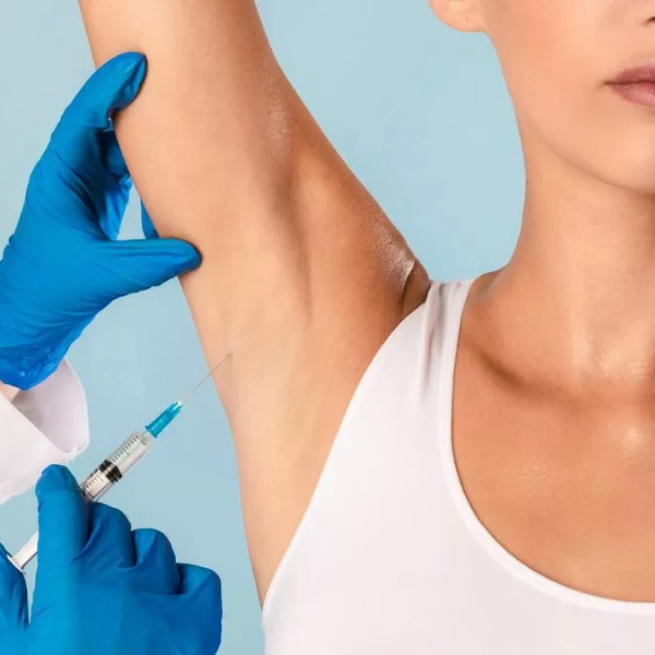 4 Hiperhidrosis Axilar- Toxina Botulínica
