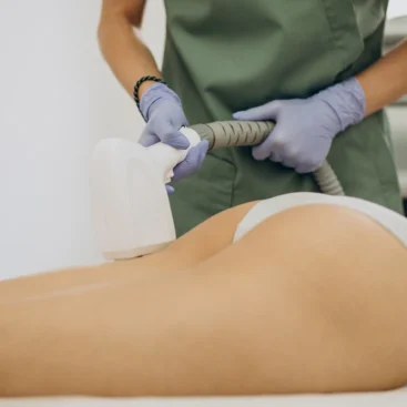 Aplicación de tratamiento HIFU 7D corporal en zona abdominal