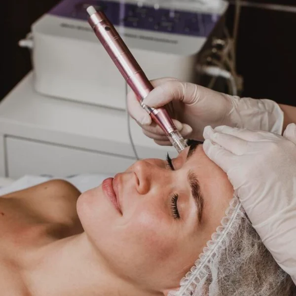 Tratamiento facial Carving Pen con tecnología HIFU 12D