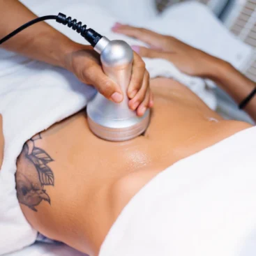 Tratamiento corporal Liposonix HIFU 12D en abdomen femenino
