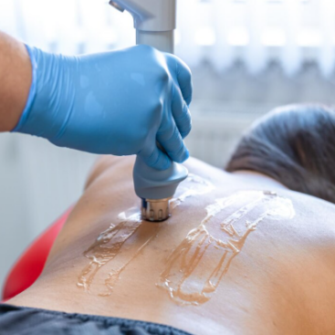 Fibrosis zona mediana