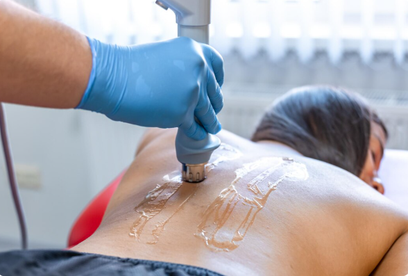 Fibrosis zona grande