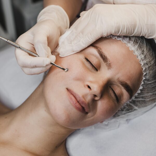 Limpieza facial acné